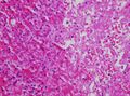 Cytoplasmic hypereosinophilia (seen in left half of image)