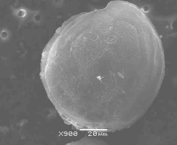 ملف:Gambierdiscus toxicus NOAA.png