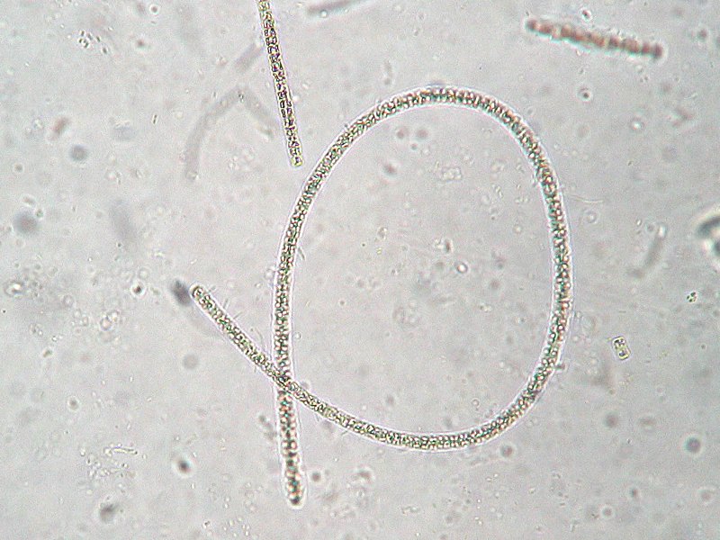 ملف:Planktothrix rubescens.jpeg