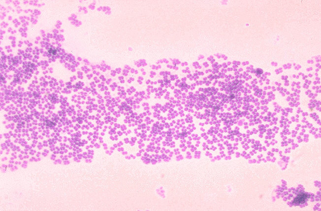 ملف:Micrococcus mucilaginosis 01.png