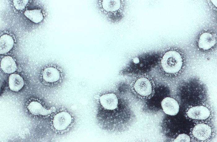 ملف:TEM of coronavirus OC43.jpg