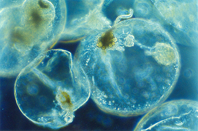 ملف:Noctiluca scintillans varias.jpg