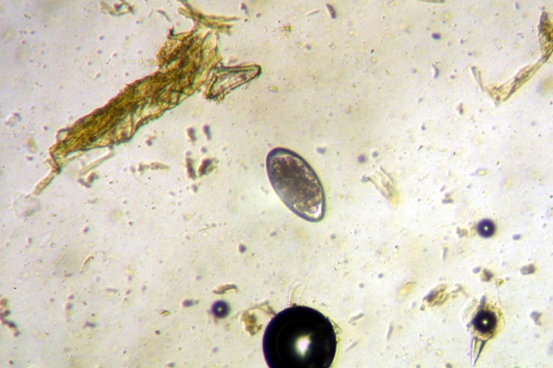 ملف:Haemonchus contortus.jpg