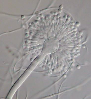 ملف:Aspergillus versicolor.jpeg