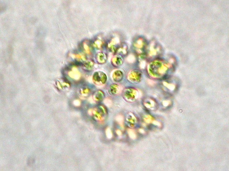 ملف:Microcystis aeruginosa.jpeg