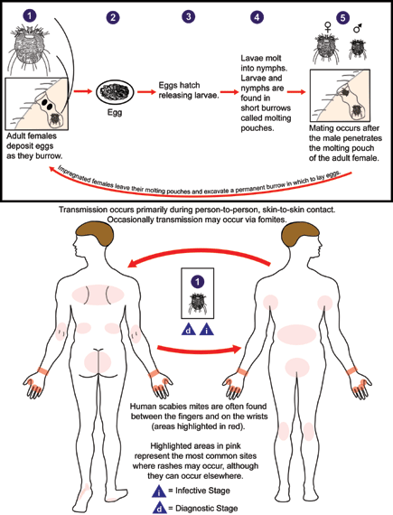 ملف:Scabies LifeCycle.gif