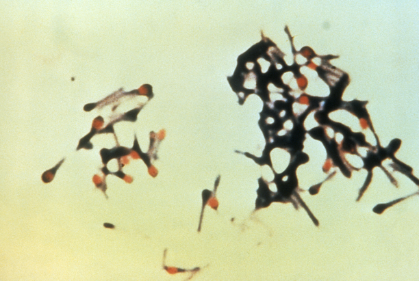 ملف:Clostridium tetani 01.png