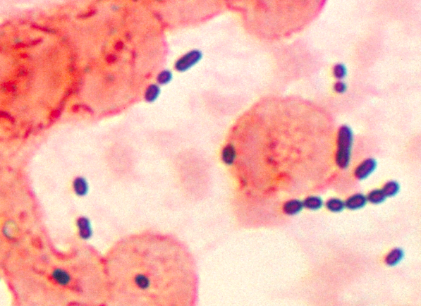 ملف:Enterococcus histological pneumonia 01.png