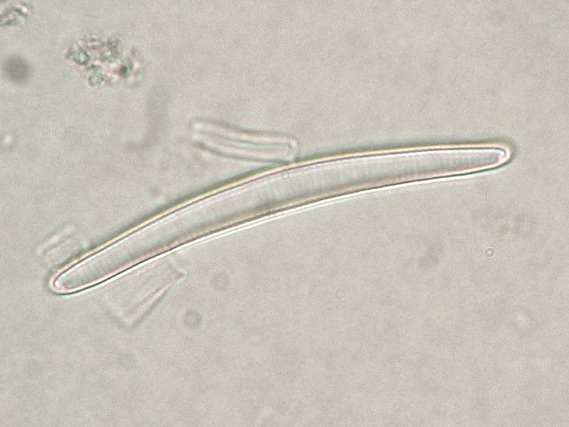 ملف:Eunotia sp.jpeg