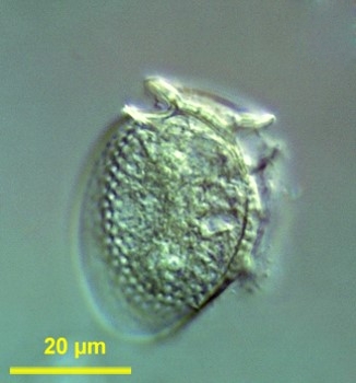 ملف:Dinophysis acuminata.jpg
