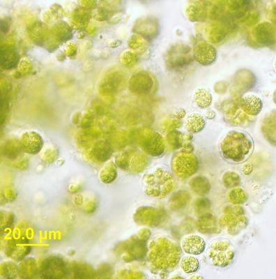 ملف:Chlorella with light microscopy.jpg