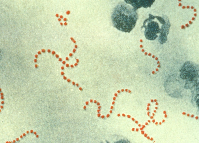ملف:Streptococcus pyogenes.jpg