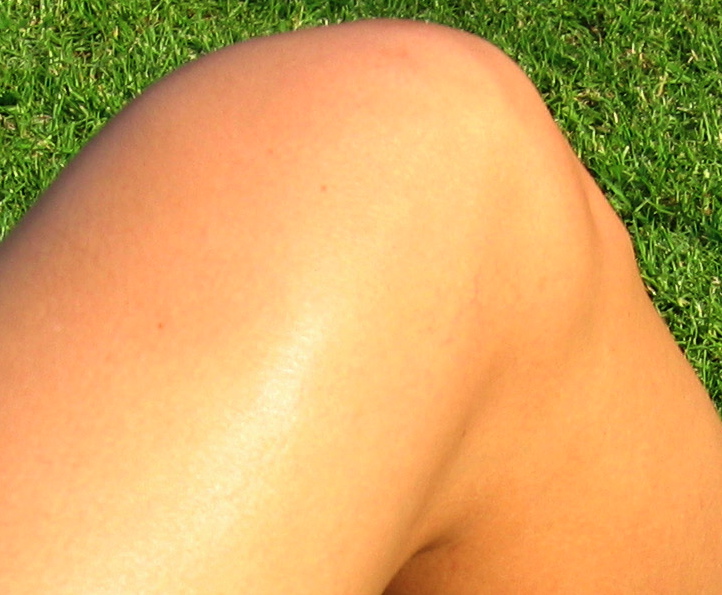 ملف:Knee.female.jpg