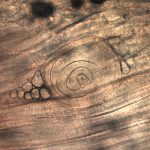 Trichinella HBb.jpg