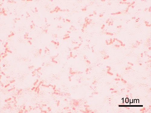 ملف:Shigella flexneri Gram.jpg