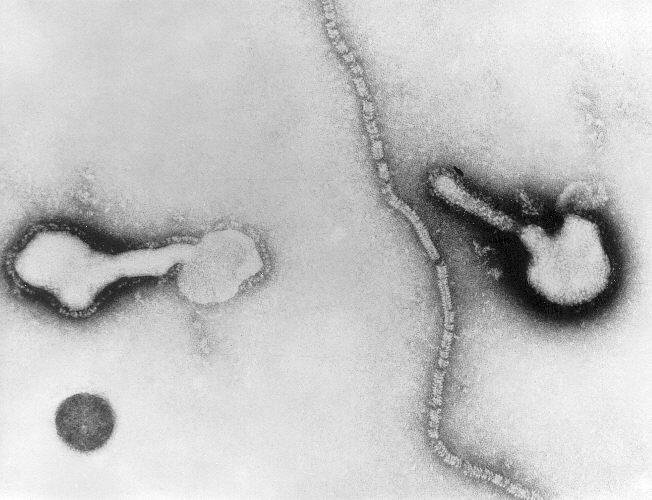 ملف:Parainfluenza virus TEM PHIL 271 lores.jpg