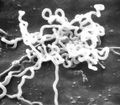 صورة مجهرية إلكترونية من البكتريا اللولبية الشاحبة