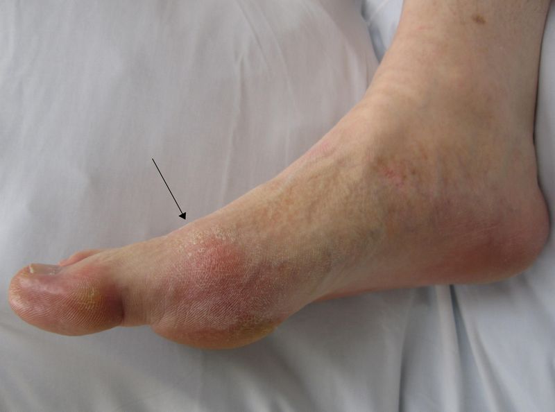 ملف:Gout2010.JPG