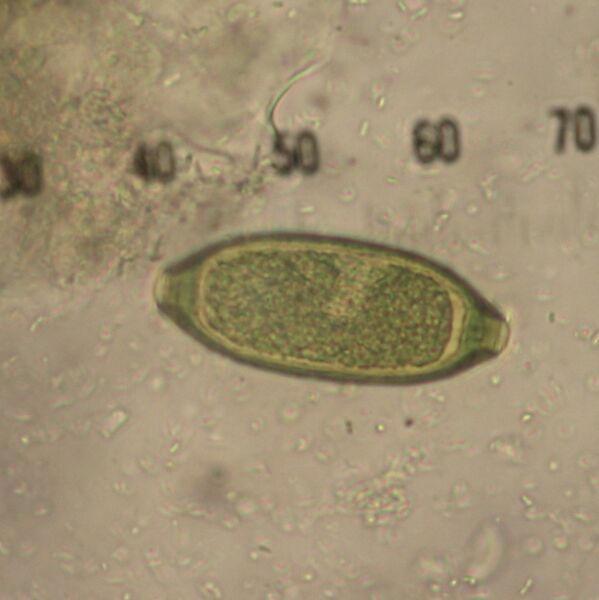 ملف:Trichuris sp.JPG