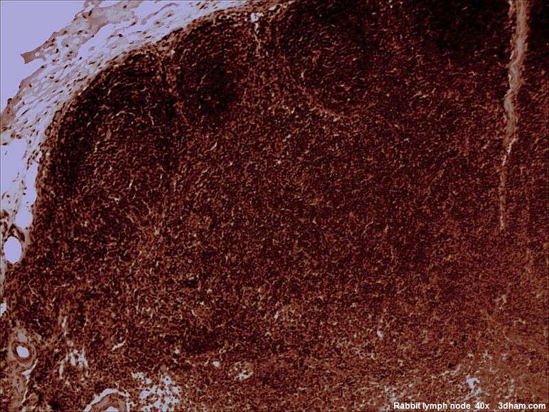 ملف:Rabbitlymphnode40x5.jpg