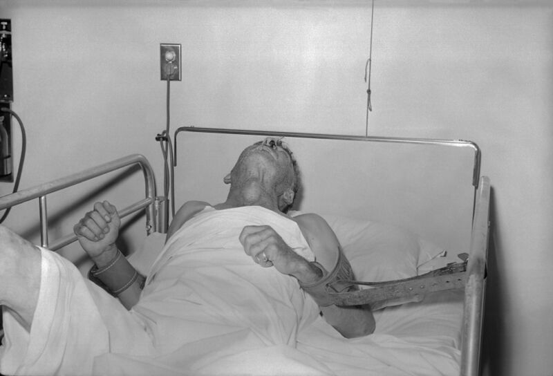 ملف:Rabies patient.jpg