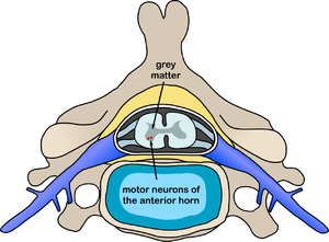 Polio spinal diagram.PNG
