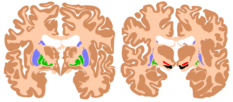 ملف:Basal ganglia.svg