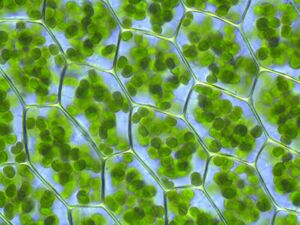 The chloroplasts of plant cells contain a high concentration of chlorophyll, making them appear green.