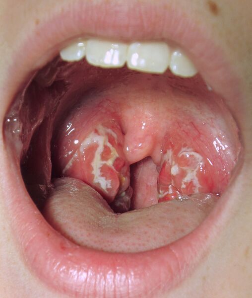 ملف:Pos strep.JPG