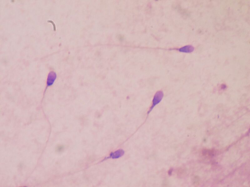 ملف:Sperm stained.JPG