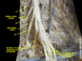 Spinal cord. Spinal membranes and nerve roots.Deep dissection. Posterior view