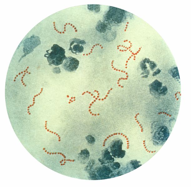 ملف:Streptococcus pyogenes 01.jpg