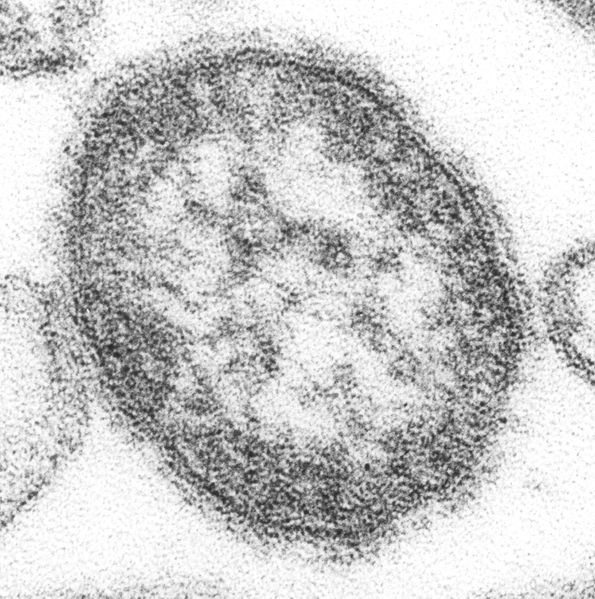 ملف:Measles virus.JPG