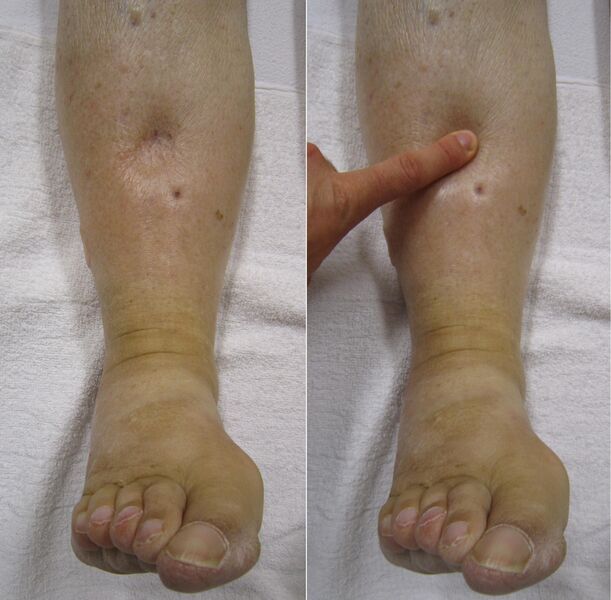 ملف:Combinpedal Right to Left.jpg