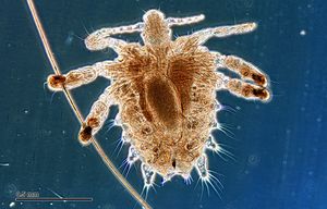 Crab louse (251 23) Female, from a human host.jpg