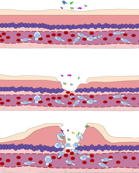 ملف:Immune response.svg