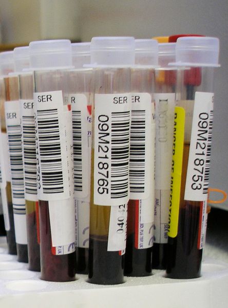 ملف:Blood test.jpg
