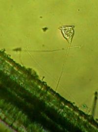 Vorticella.JPG