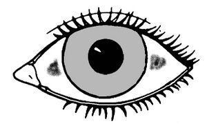 Typical location of Bitot's spots.jpg