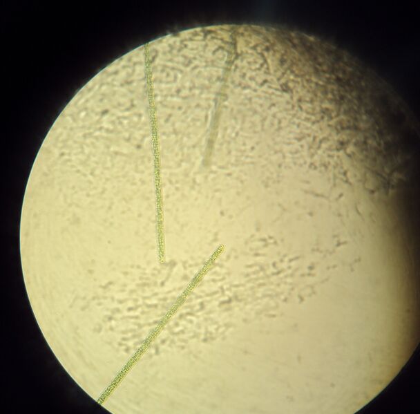 ملف:Planktothrix-agardhii.JPG