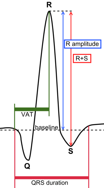 ملف:QRS complex.png