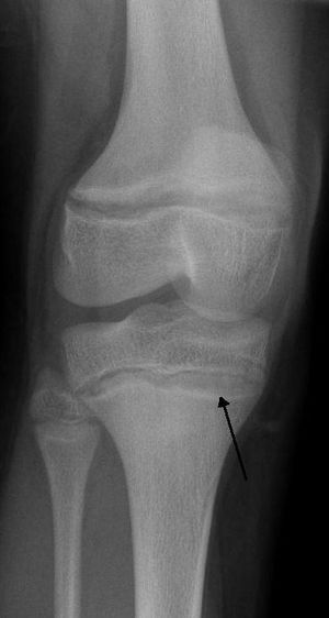 Lead PoisoningRadio.jpg