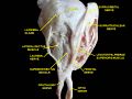 Extrinsic eye muscle. Nerves of orbita. Deep dissection.