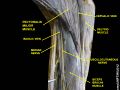 The proximal part of the left biceps brachii muscle