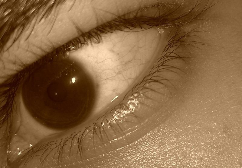ملف:Human eye real.jpg
