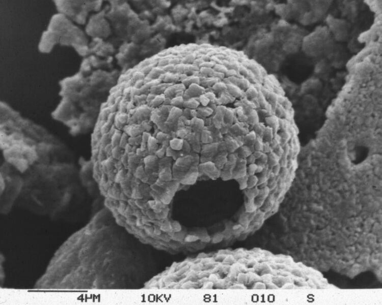 ملف:Thoracosphaera-heimi2 hg.jpg