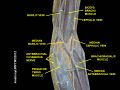 The middle and distal third of the left biceps brachii muscle