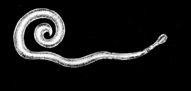 ملف:Oxyuris vermicularis.jpg