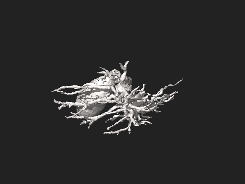 ملف:3DPX-002306 Biliary tract MRCP Nevit Dilmen.stl