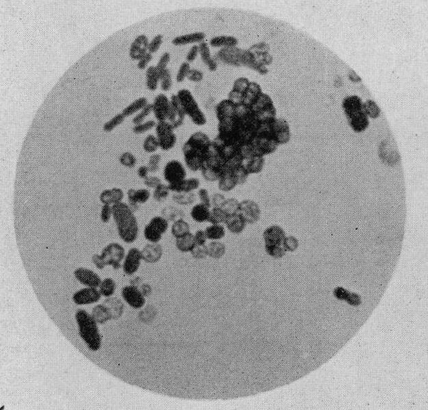 ملف:Azotobacter cells.jpg